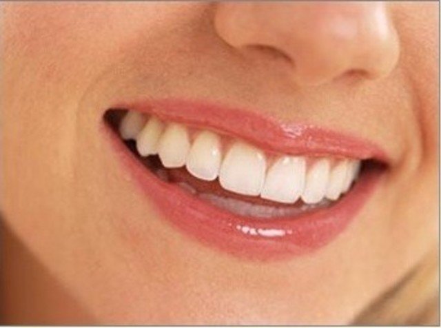 Как выглядят идеальные зубы и часто ли это бывает? 